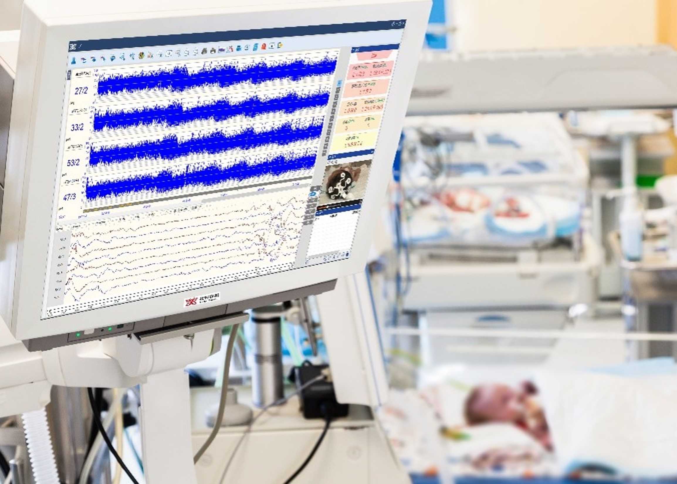 NICU和PICU